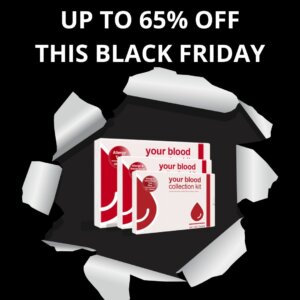 UP TO 65% OFF THIS BLACK FRIDAY